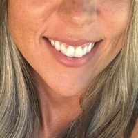 бејзболмам Голе