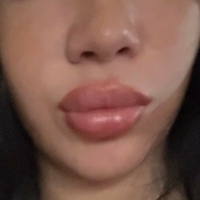 Беллаагом Голе