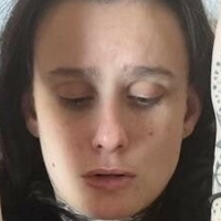 Басти Банни Голе