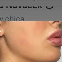 Чески Чика Голе
