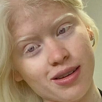 Гуада Скарионе Голе