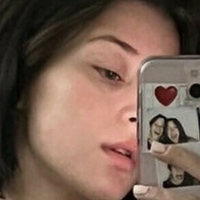 Ицселлексо Голе