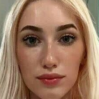 Онли Стела Вип Голе