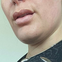 Сквиши Беј Голе