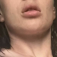 тейланорт_ Голе