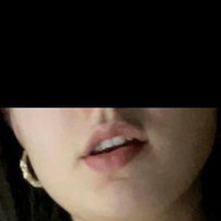 TheDarkRose Голе