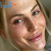 Тајлер Лорен Голе