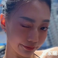 зебра_јанг Голе